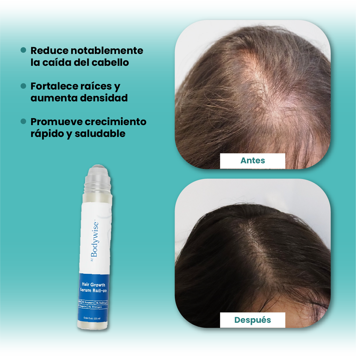 Suero Crecimiento Capilar