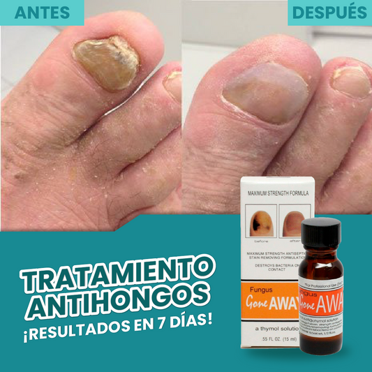 TRATAMIENTO ANTIHONGOS